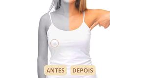 NIPPLE DESCARTÁVEL - PROTETOR DE MAMILO - BEGE